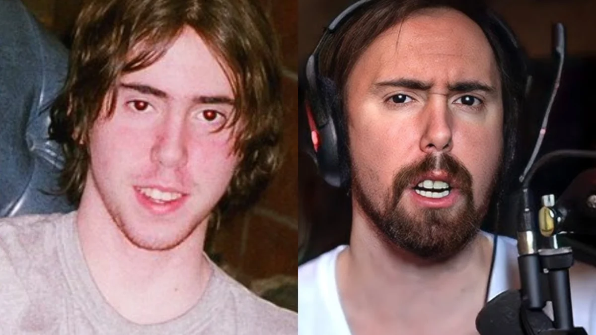 Asmongold Issues Stark Warning on Dental Hygiene After Facial Changes Linked to Tooth Loss