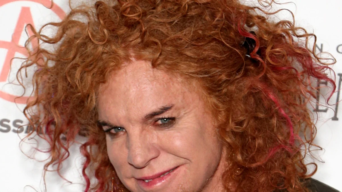 Carrot Top Released From Hospital … Home With Family
