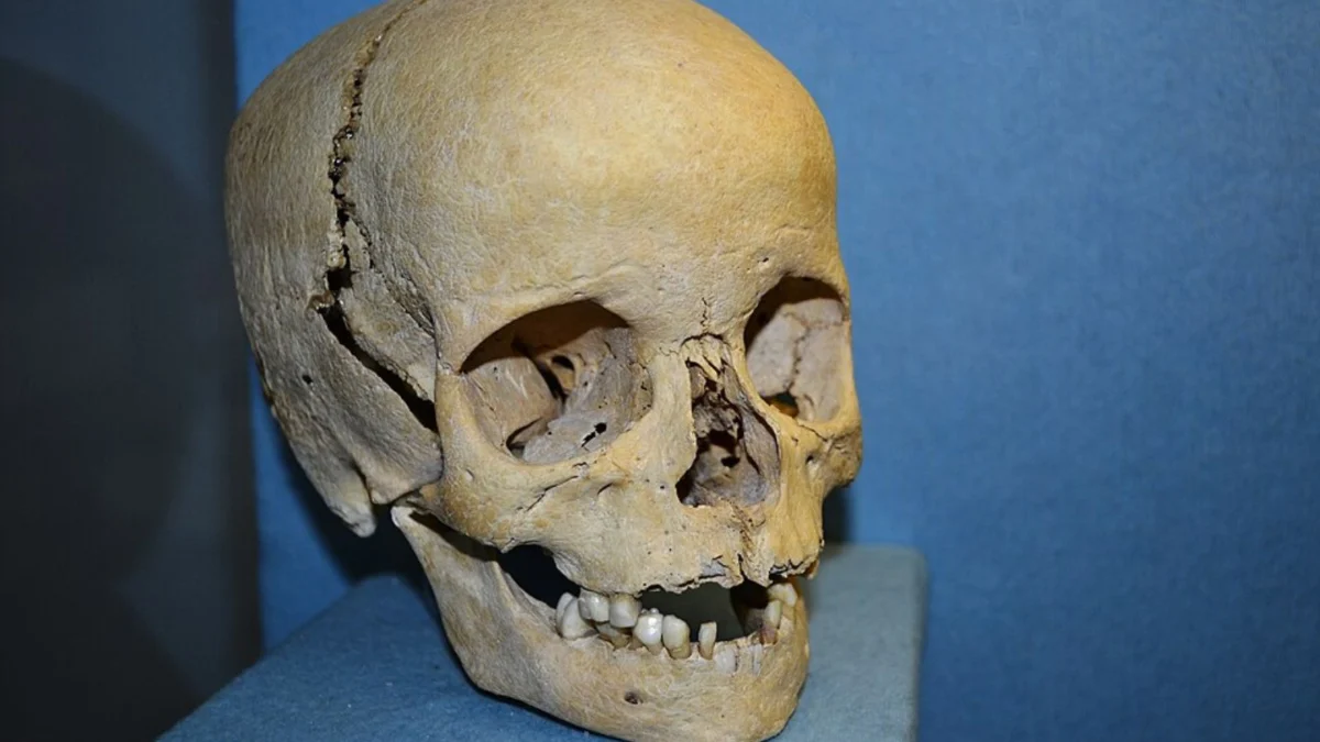 YouTuber Horses Faces Ethical Scrutiny After Listing Real Human Skull as Merchandise for Three Thousand Dollars